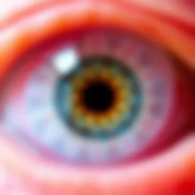 Magnificent Psoriatic Uveitis: Treatment Strategies and Considerations Magnificent Psoriatic Uveitis: Treatment Strategies and Considerations