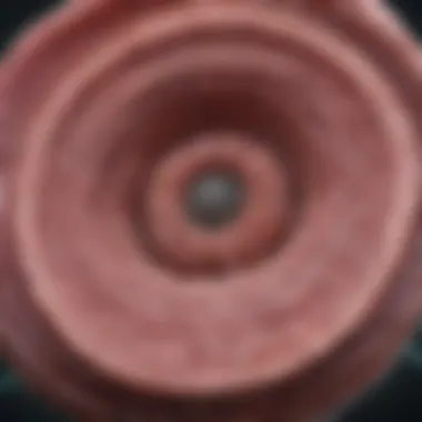 Magnificent Understanding Stage 1 Bile Duct Cancer