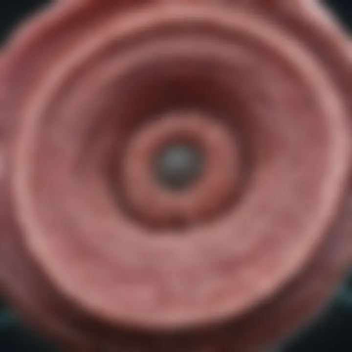 Magnificent Understanding Stage 1 Bile Duct Cancer