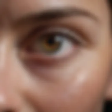 Common Eye Symptoms in RA Visual representation of common eye symptoms in rheumatoid arthritis patients