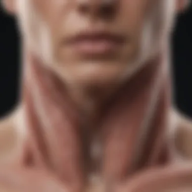Causes of Left Diaphragm Paralysis Illustration of causes leading to left diaphragm paralysis