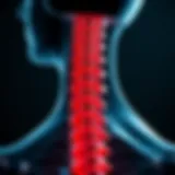 Impact of Spinal Lymphoma on the Vertebral Column Illustration of spinal lymphoma affecting the vertebral column