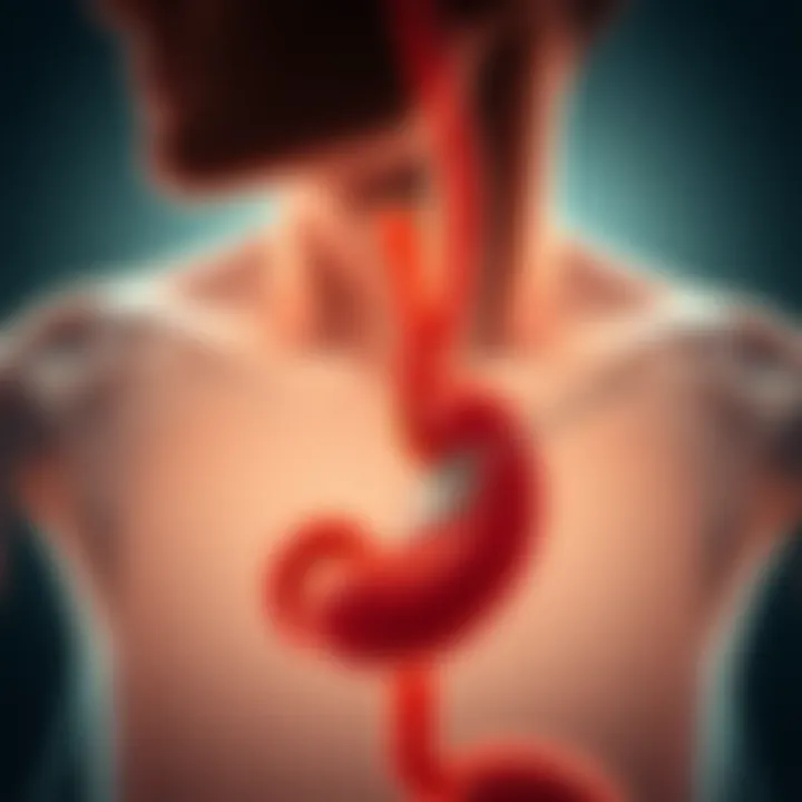Symptoms of Gastroesophageal Reflux Disease Illustration of common symptoms associated with GERD