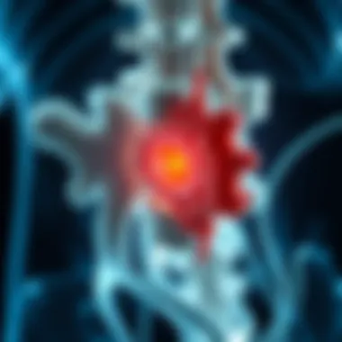 Pathologies of L4 and L5 Discs Common pathologies affecting L4 and L5 discs