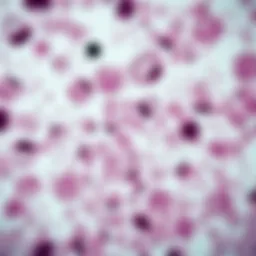 Microscopic view of lung adenocarcinoma cell culture