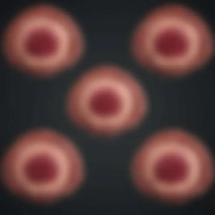 Diagram illustrating the stages of prostate cancer progression