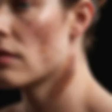 Illustration of the different types of psoriasis affecting earlobes