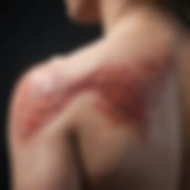 The relationship between psoriasis and cardiovascular diseases