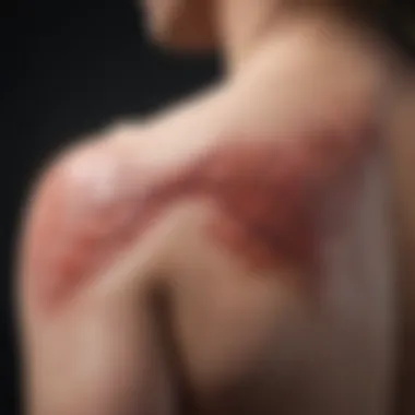 Psoriasis and Cardiovascular Health The relationship between psoriasis and cardiovascular diseases