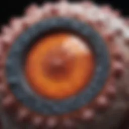 Microscopic view of squamous cell carcinoma