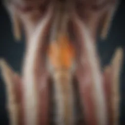 Detailed illustration of spinal canal narrowing in stenosis