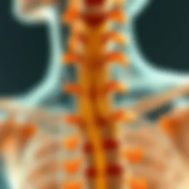 An illustration depicting the anatomy of the spinal cord and syrinx formation