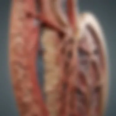 Plaque Buildup in Arteries Illustration of plaque buildup in arterial walls