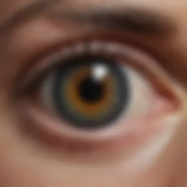 Ocular Complications Resulting from Stroke Graphic representation of ocular complications resulting from stroke