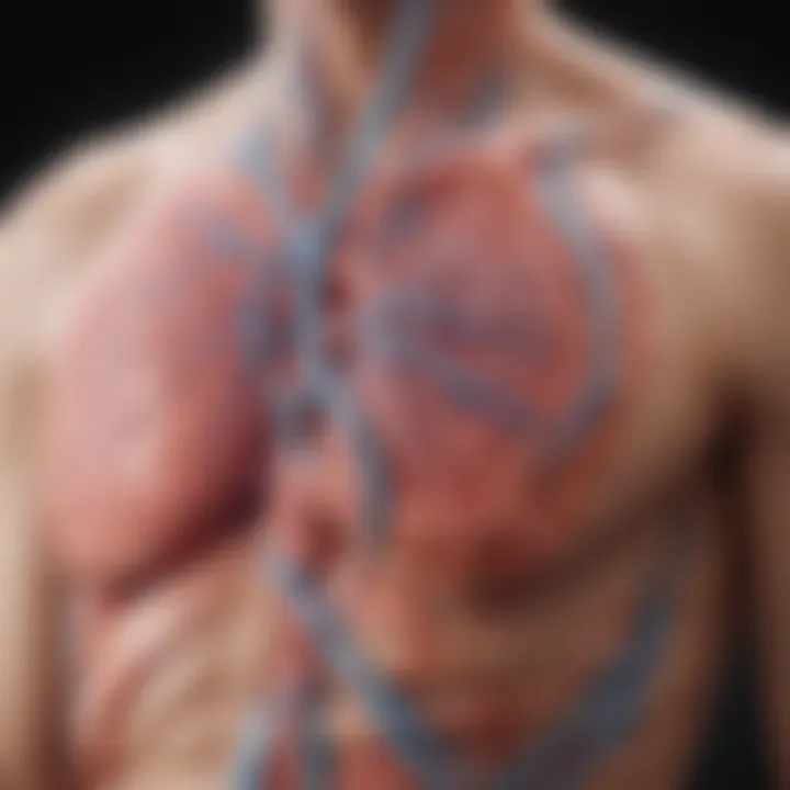 Diagram illustrating the pathophysiology of malignant pleural effusion.