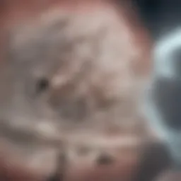 Cardiac MRI showing myocarditis