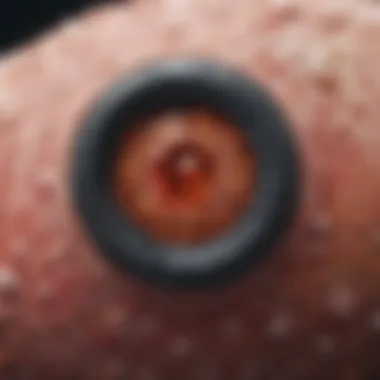 Microscopic Insights into Kaposi's Sarcoma Microscopic view of Kaposi's sarcoma lesions