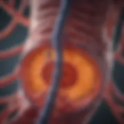 Anatomical illustration of colorectal cancer and its metastatic pathways