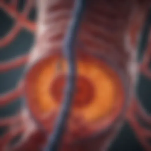 Anatomical illustration of colorectal cancer and its metastatic pathways