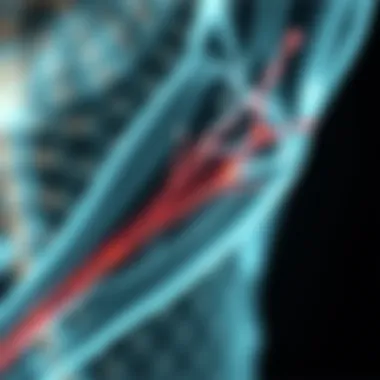 Visualization of skeletal muscle fibers affected by myasthenia gravis