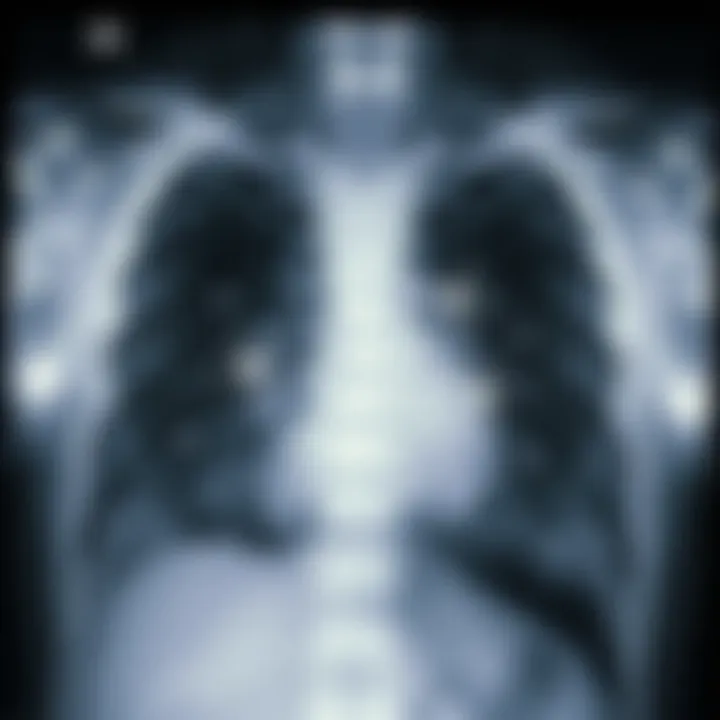X-ray highlighting pulmonary changes