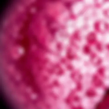 Microscopic view of squamous cell carcinoma cells