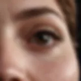 A close-up examination of atypical moles
