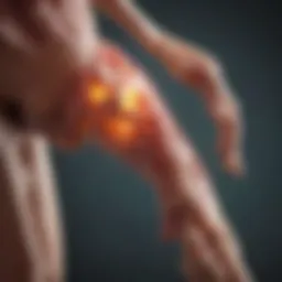 Illustration depicting the inflammatory response in joints affected by rheumatoid arthritis.